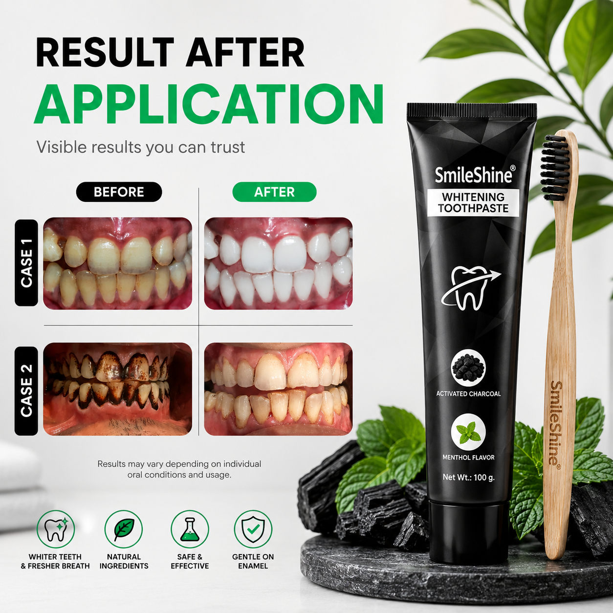 SmiloShine® Signature Teeth Whitening Ritual (3-in-1 Home Kit)